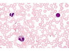 Blut/Mensch Präparate und Foliensätze