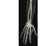 Röntgenbilder Mensch 2