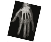 Röntgenbilder Mensch 4