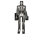 Röntgenbilder Mensch 5