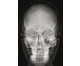 Röntgenbilder Mensch 6