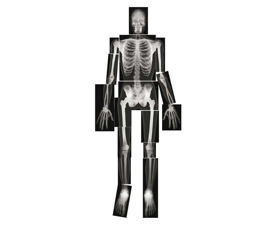 ROYLCO Röntgenbilder Mensch