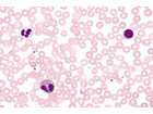 Blut/Mensch Präparate und Foliensätze